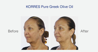 Korres. All in one skincare multi-tasker with Pure Greek Olive Oil, formulated to restore vital antioxidants, vitamins and omega fatty acids that nourish and hydrate skin. Small green bottle with black stopper. Before and after picture demonstrating amazing results. 